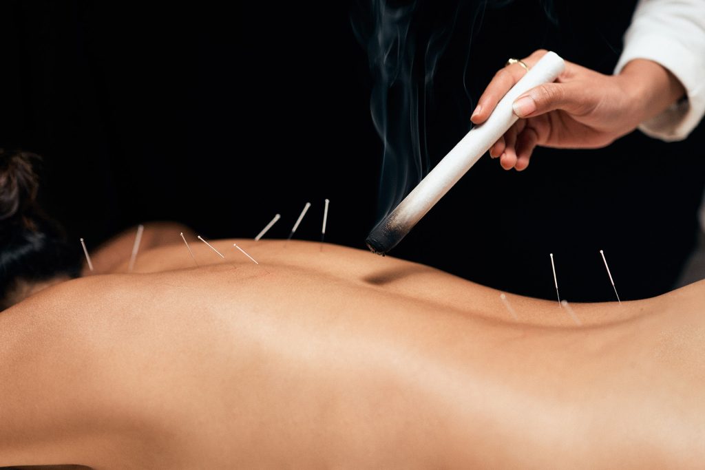 tulah-life-le-nord-du-kerala-en-inde-soins-massages-acupuncture-_0002_Moxa treatment - Image shot by Gokull Rao Kadam